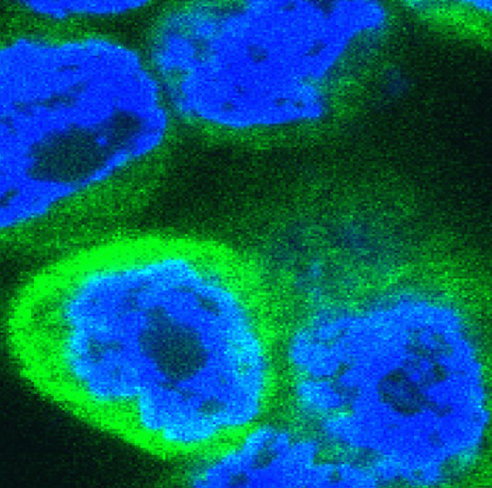 Human cells expressing inflammatory cytokines (stained green)